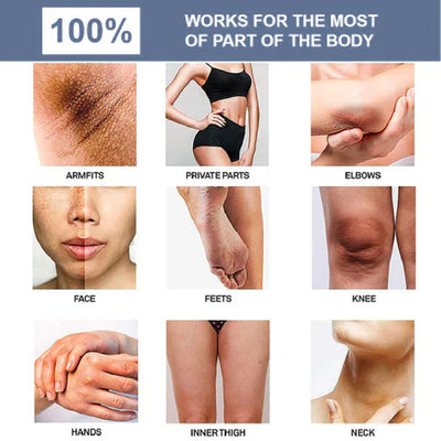 Cleansing Lotion for Acne & Spots & Nigricans, Skinenjoy Cleanser, Nigricans Cleansing Lotion for All Skin